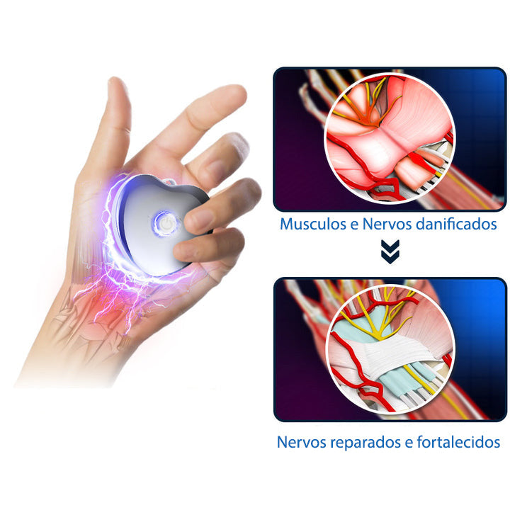 NerveEase - Dispositivo de tratamento articulares.