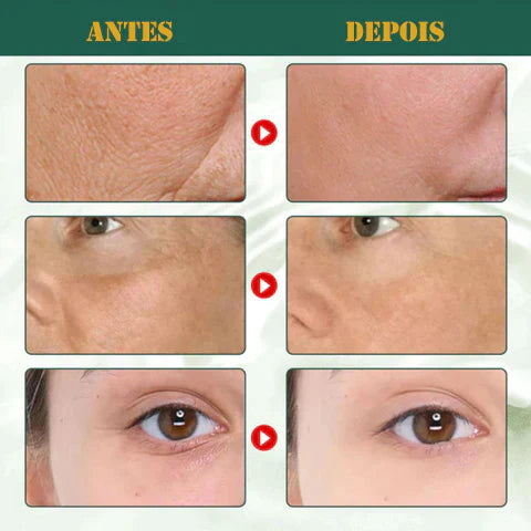 Sérum Anti-idade- Fonte da juventude e Rejuvenescedor da pele