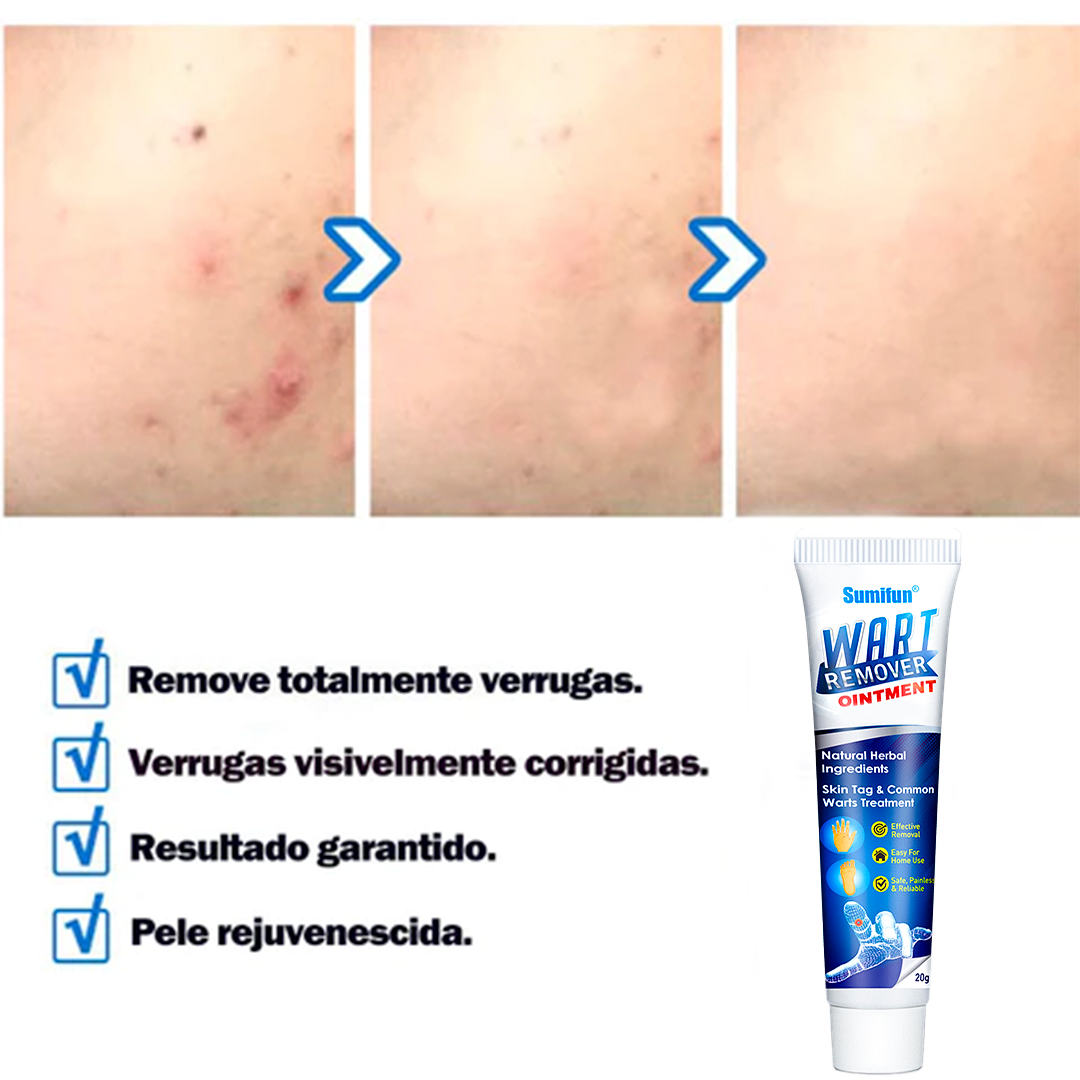 Wart-off-Removedor de verrugas
