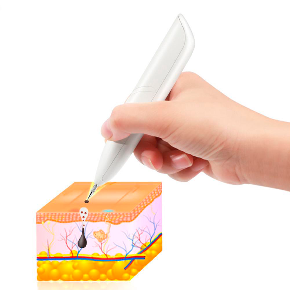 Caneta Plasma Removedora de Pintas/Manchas/Verrugas/Tatuagens