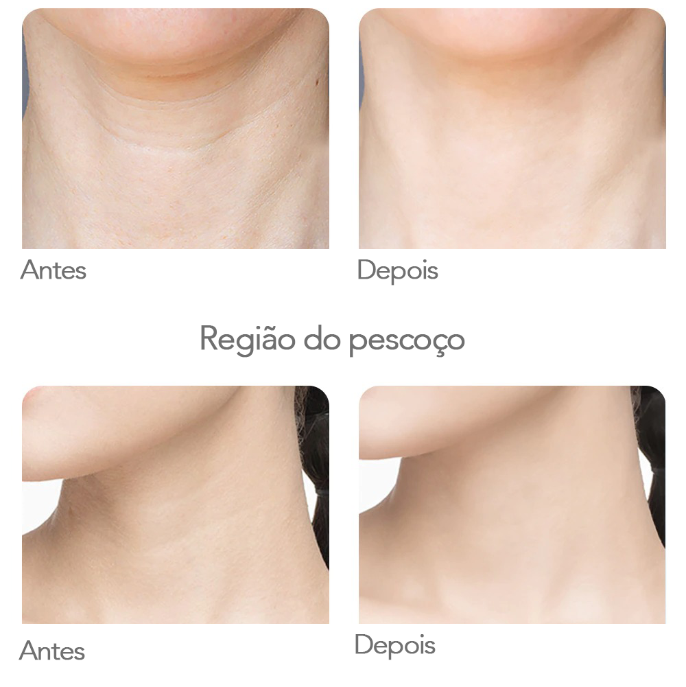 LED Inibidor de Linhas de Expressões - Tratamento por frequência de ondas