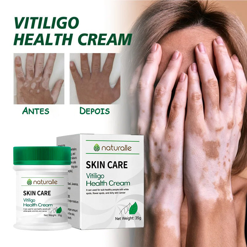 Vitiligo Cream - Uniformizador de manchas brancas no corpo!