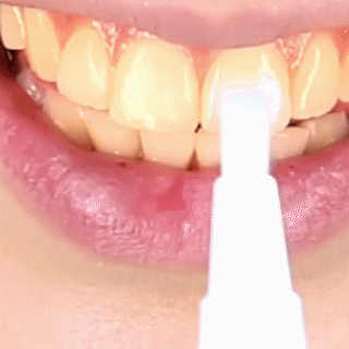 LuminousDent-Dentes brancos.