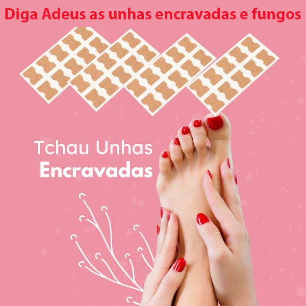 Adesivo corretor para unhas encravadas-Corrector Sticker
