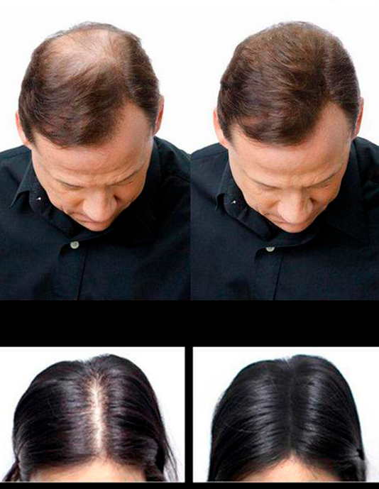 Instant Hair | Pó corretor de falhas para cabelos e sobrancelhas