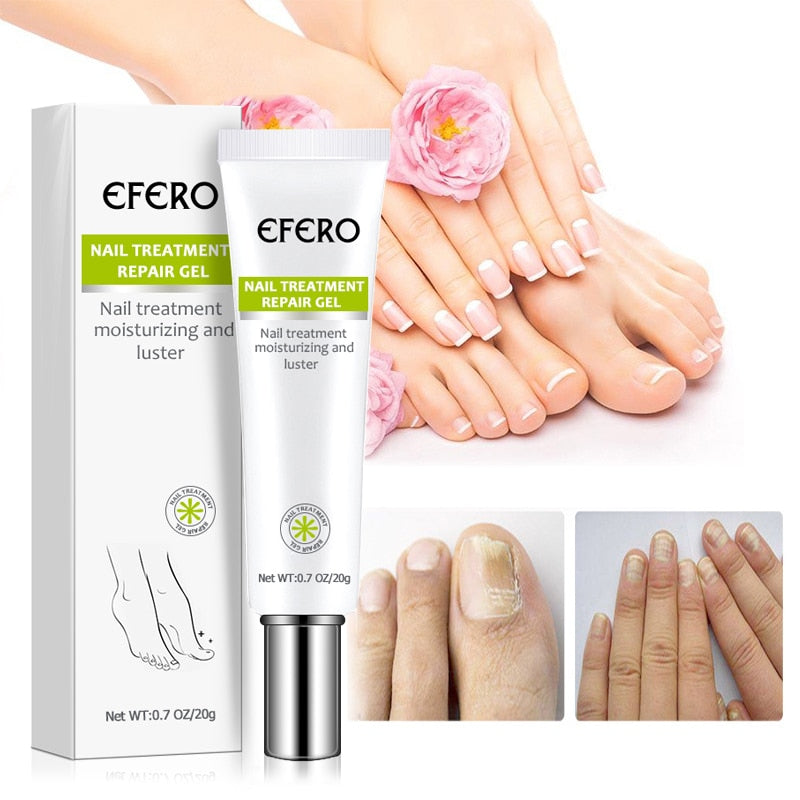 Efero Nails - Creme Anti-Inflamatório para remoção de fungos e fortalecimento das unhas