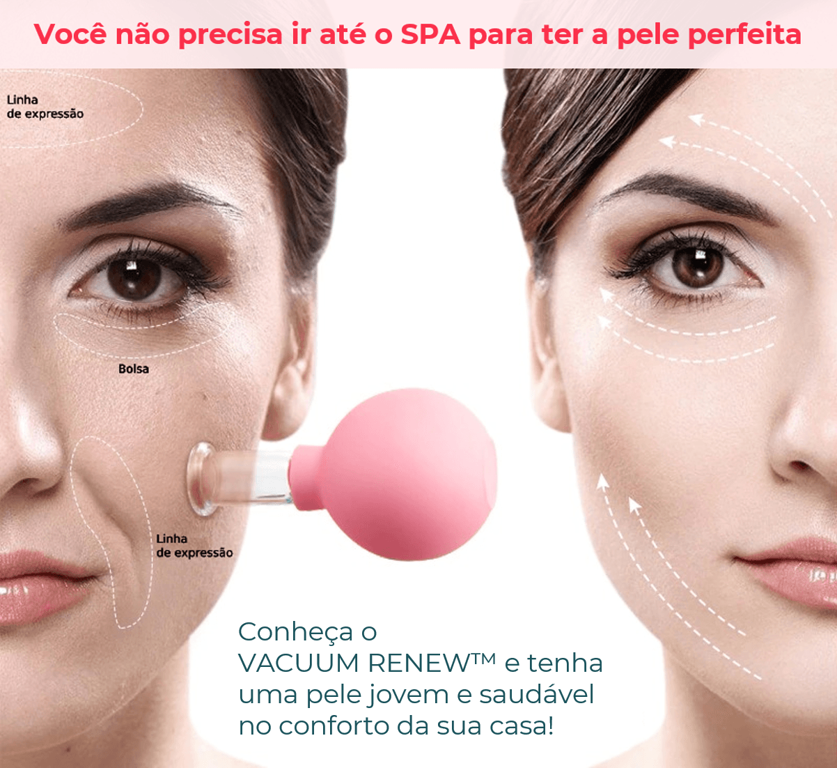 VACUUM RENEW - ANTIRRUGAS E ANTICELULITE