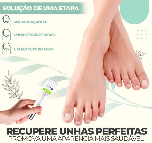 Efero Nails - Creme Anti-Inflamatório para remoção de fungos e fortalecimento das unhas