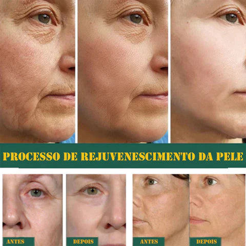 Sérum Anti-idade- Fonte da juventude e Rejuvenescedor da pele